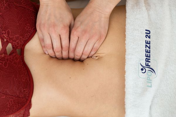 diastasis recti treatment Barking and Dagenham