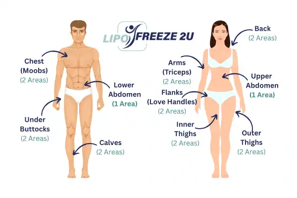Areas you can have fat freezing treatment Barking and Dagenham