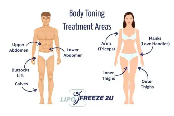 Graphic showing where you can have Body toning Treatment Barking and Dagenham on your body