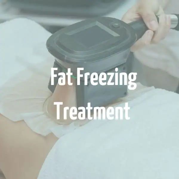 fat freezing treatment Barking and Dagenham