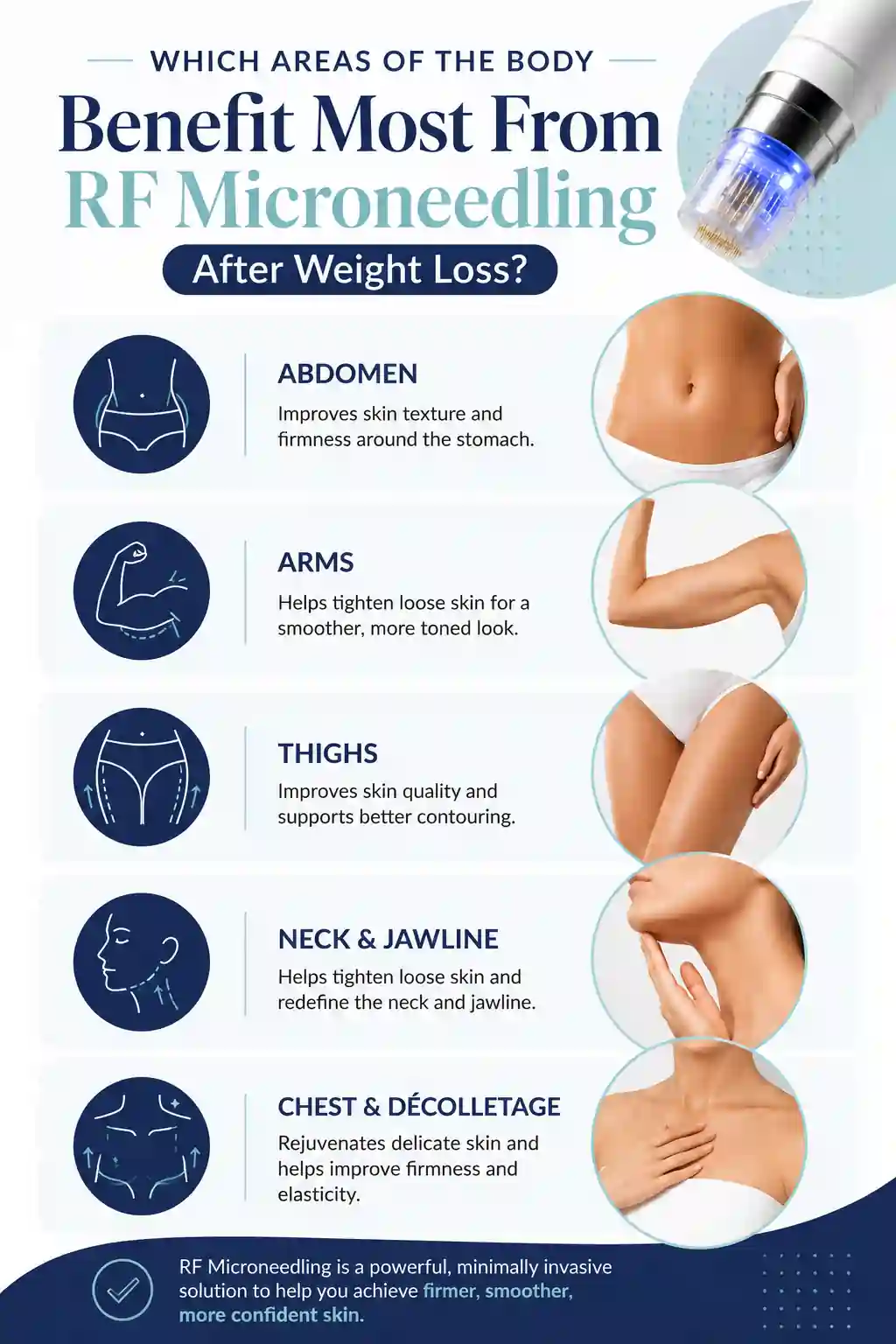Which Areas of the Body Benefit Most From RF Microneedling After Weight Loss Barking and Dagenham